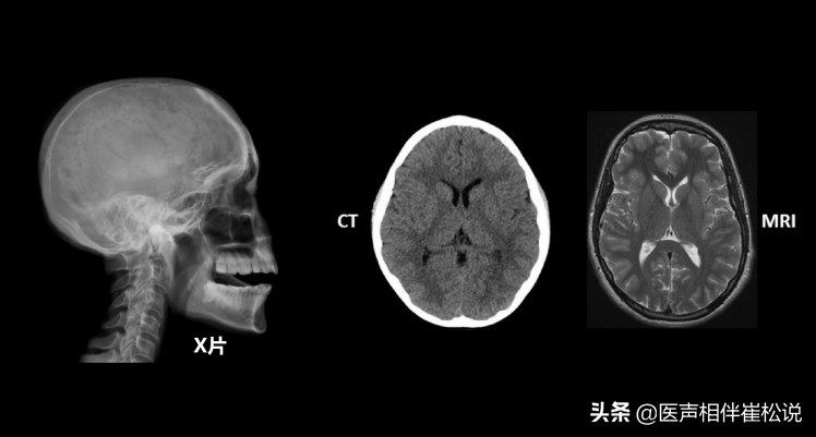 得了病，到底做哪种检查好？X片、CT还是磁共振？