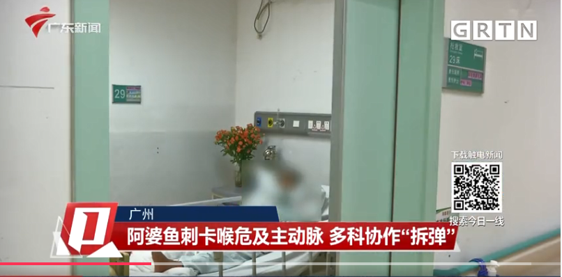 鱼刺卡喉，别再用吞饭、喝醋等“土方法”了！告诉您正确处理方法