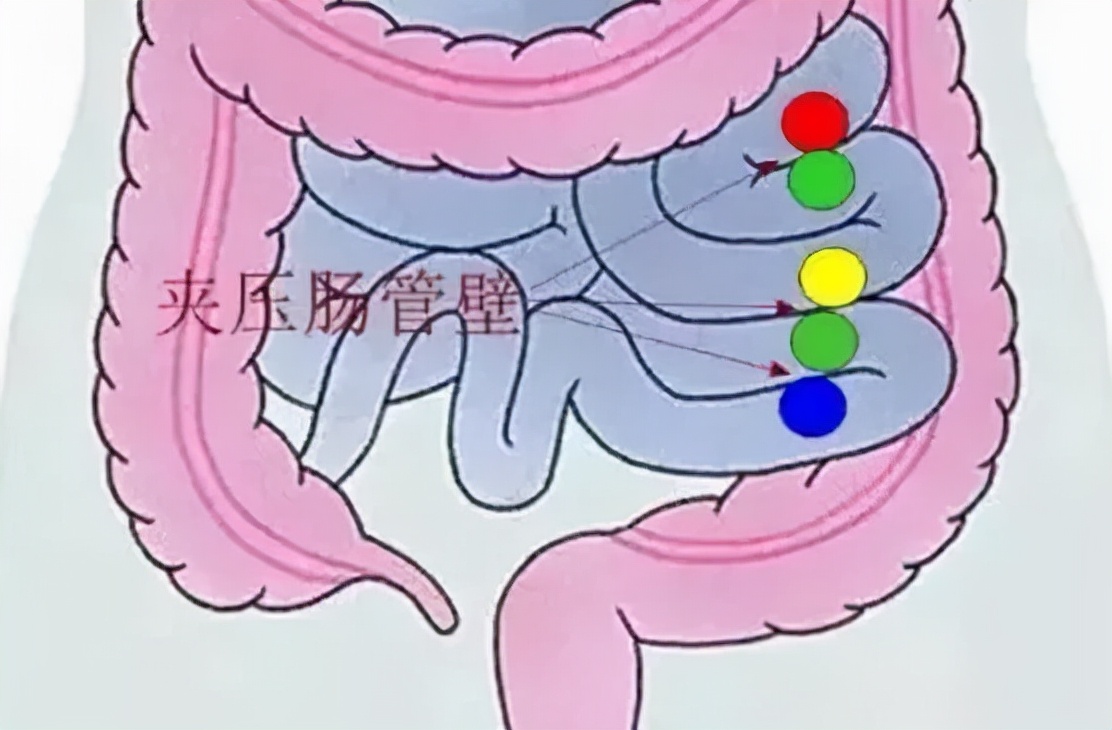 致多名儿童肠穿孔，央视曝光的这款益智玩具，早该被骂上热搜