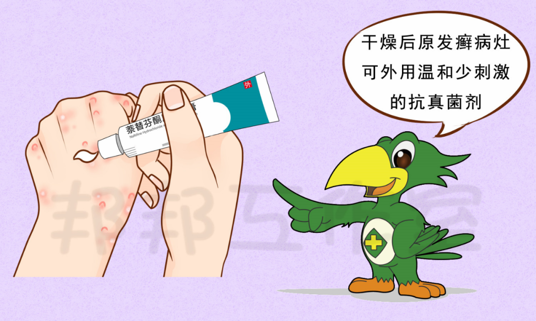 易误诊的癣菌疹
