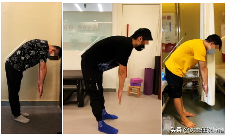 腰痛、下肢麻木未必是腰症！如何辨别腰椎间盘突出症？