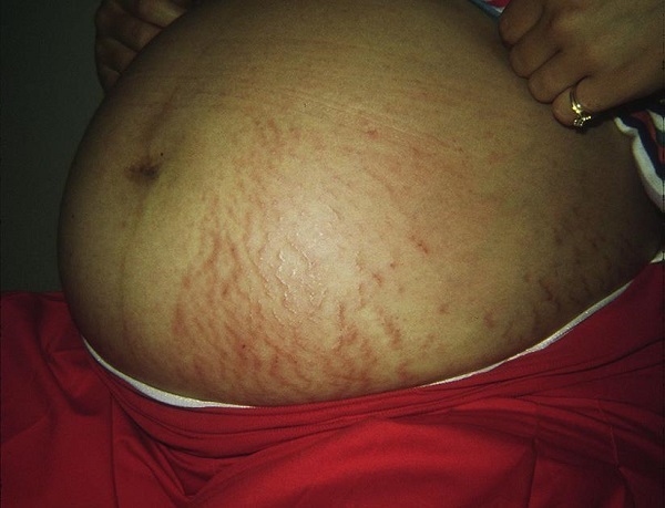 孕期皮肤瘙痒该看哪个科？