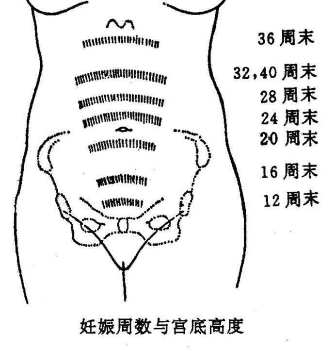 孕妈要搞清