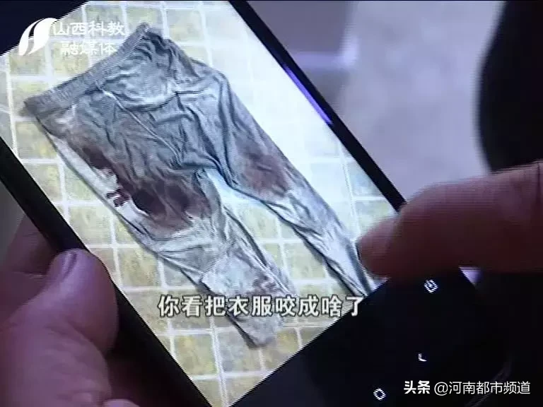 山西一小区流浪狗突然发狂!接连咬伤19人后逃了!其中还有孩子