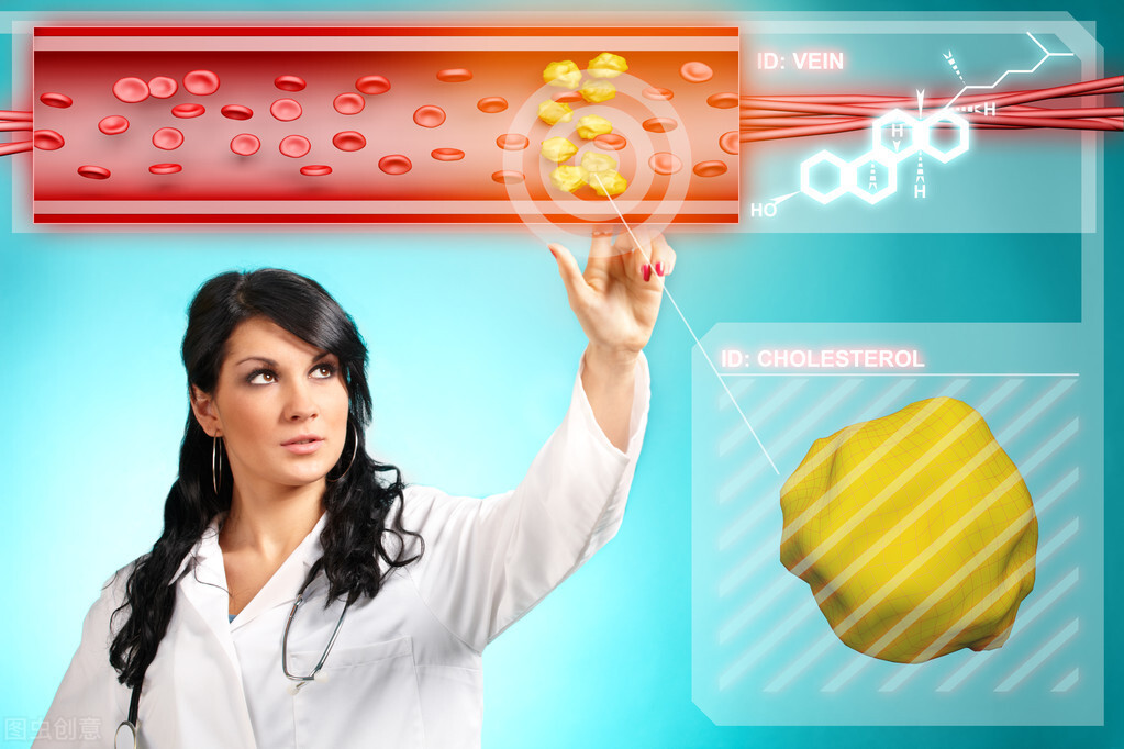 查出胆固醇“过高”，几个饮食建议，医生希望你能听进去