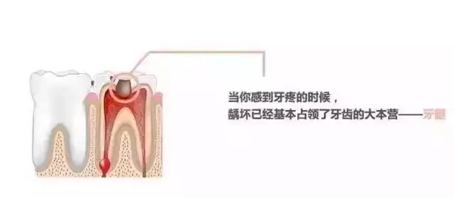 你补过牙吗?知道价格为什么差那么多吗?
