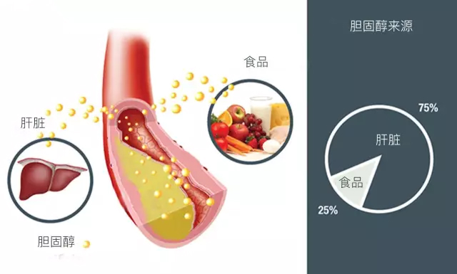 每年体检血脂“正常”却突发心梗？教你读懂血脂化验单