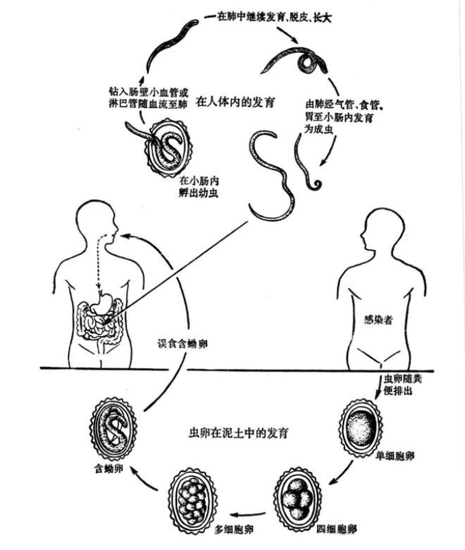 几十年前，几乎人人肚子里都有的蛔虫，为何现在没有人听说过了？