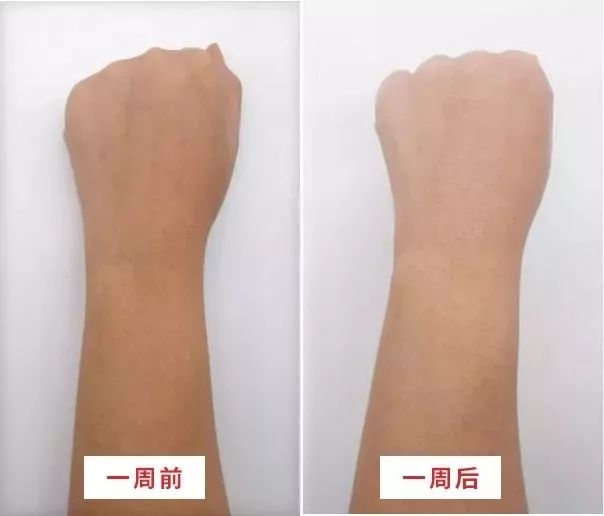 寒冬来了，身上又起皮干燥？戚薇教你一妙招，只需抹一下就好