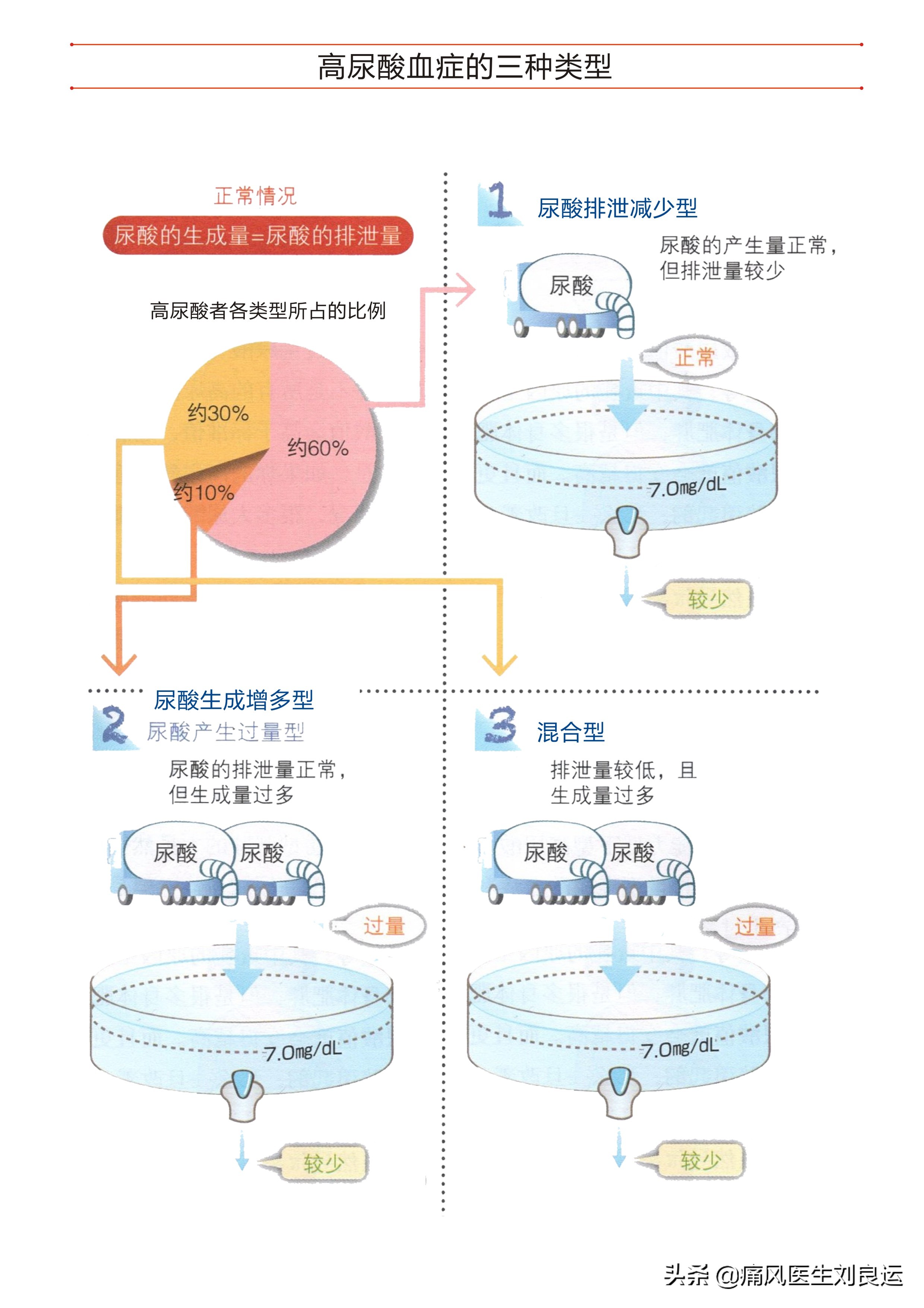 痛风患者降尿酸选哪种药？七种方法分辨尿酸生成过多还是排泄减少