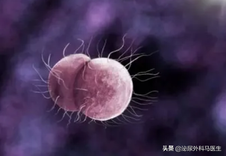 男性尿道口总有分泌物是怎么回事？正常吗？