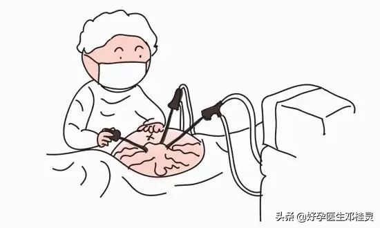 备孕科普:为什么很多医生会建议不孕的你做宫腹腔镜联合手术?