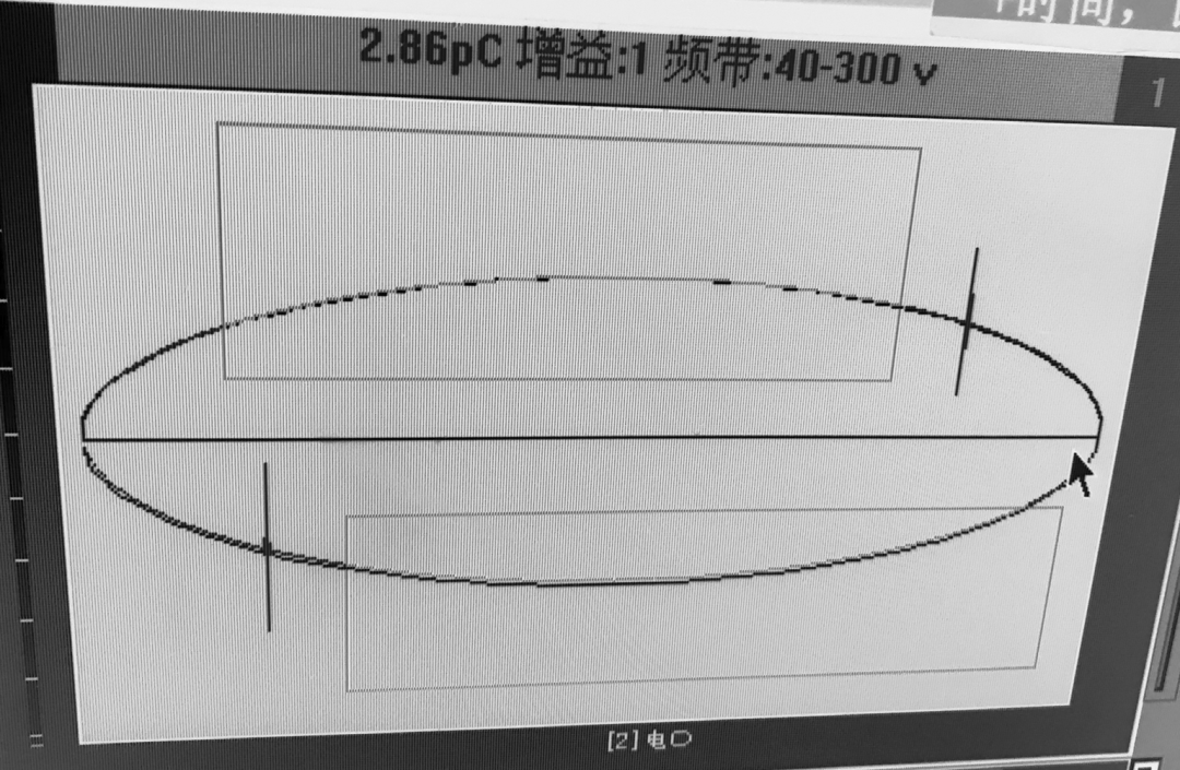 12kV固體絕緣環(huán)網(wǎng)柜開關模塊的局部放電問題分析