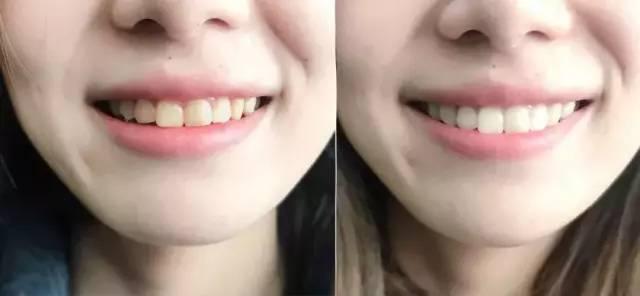 为什么口臭的人自己闻不到？教你正确做法，呼吸都是“甜”的