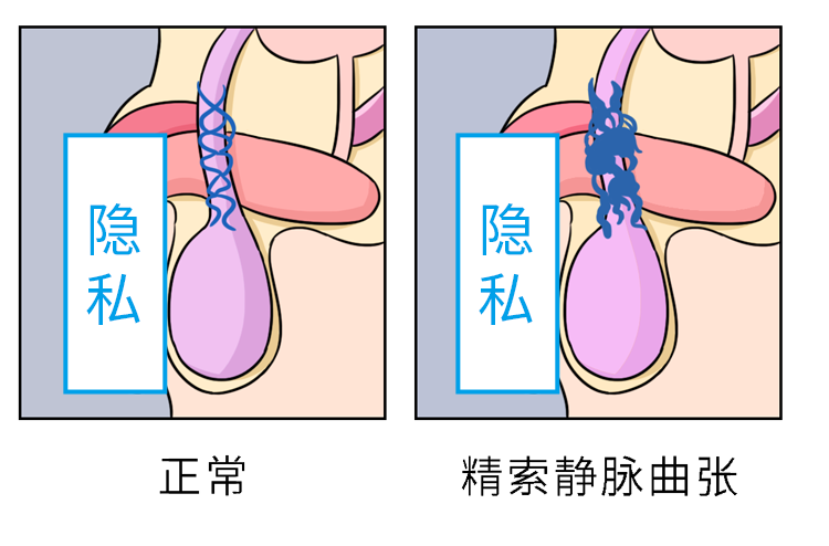 裤子脱掉查一下！泌尿外科里让人“脸红”的病，比一比哪个更尴尬