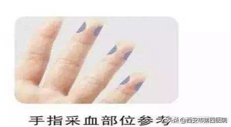 日常采血中的大学问!你都知道吗?