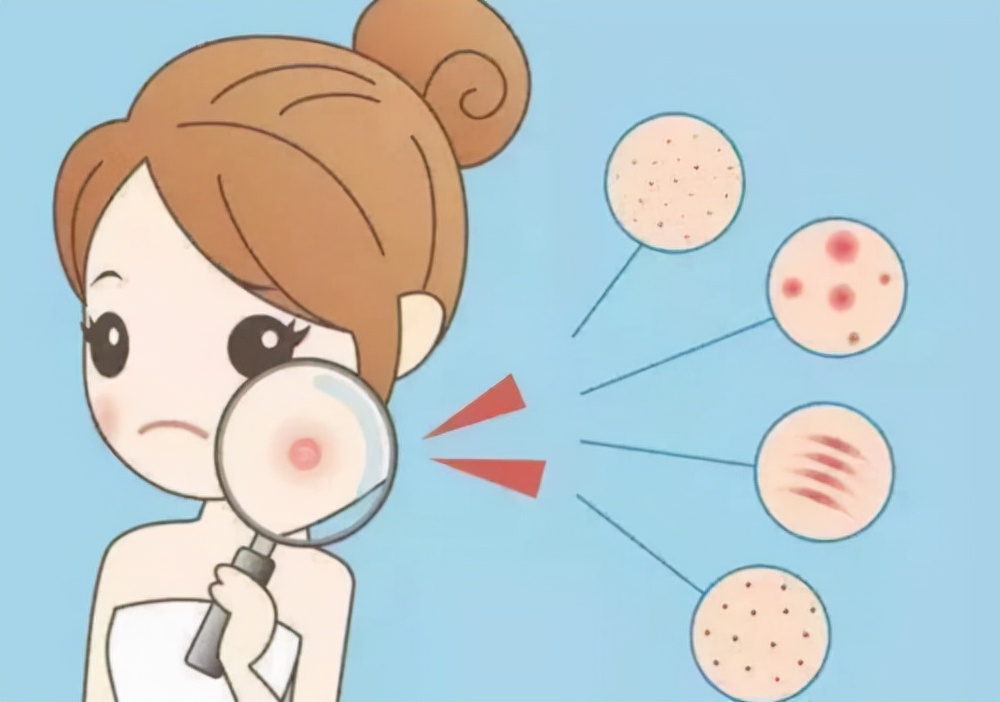 脸部过敏发红发痒紧绷……皮肤屏障受损怎么救?