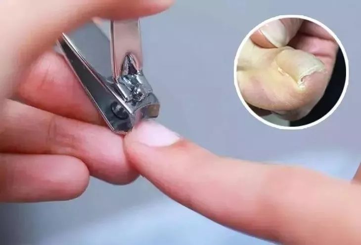 “值得敬佩”的德国制造，有126年历史的指甲刀！剪完不用磨