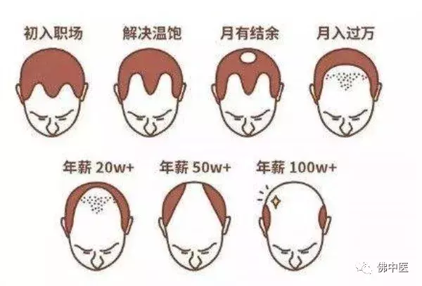 拿什么拯救你,我的发际线?中医专家有话说