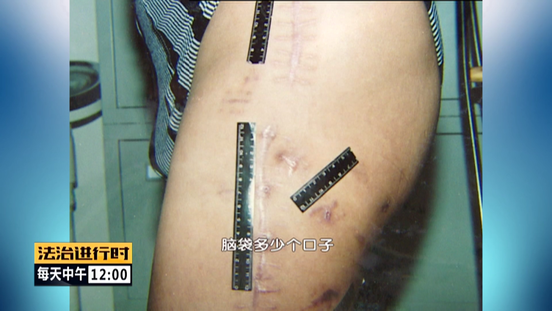 北京大案纪实：黑车司机遭活埋，全身多处刀伤，警方追凶14年