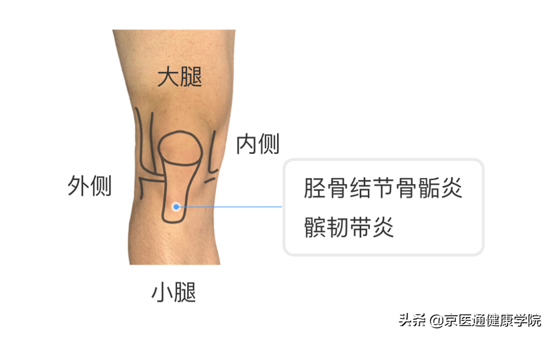 膝盖疼是什么病？积水潭专家教你1个动作判断