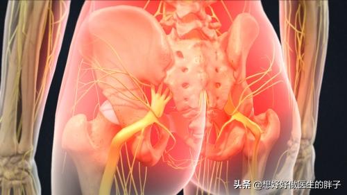 坐骨神经在哪?为啥它会疼?诱发疼的原因?如何治疗?医生告诉您