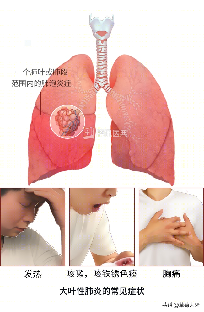孩子咳嗽两个多月都不好，医生让我试试给孩子肺“洗澡”？
