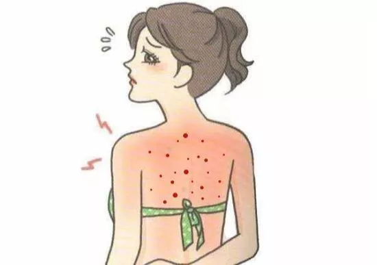 如何调理痘痘粉刺?教你3个食疗方