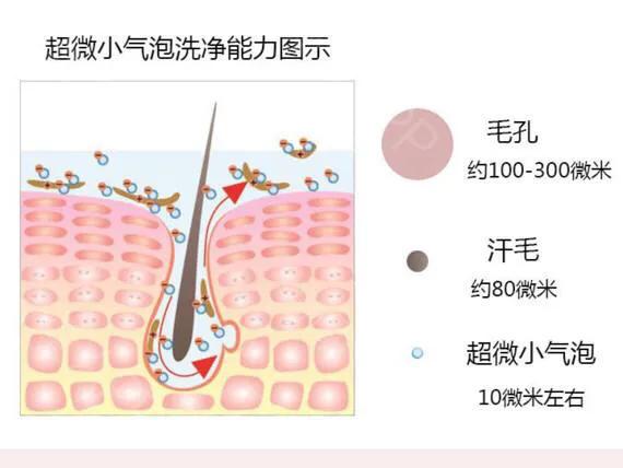 黑头就做小气泡！医美小气泡到底是什么，有用吗？亲身经历告诉你