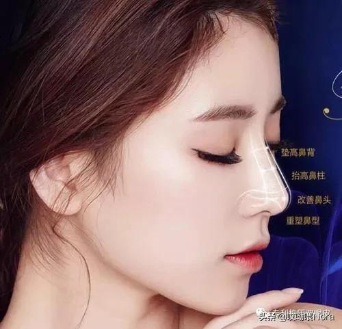 十种鼻型图片（图文讲解10种不同的鼻型）