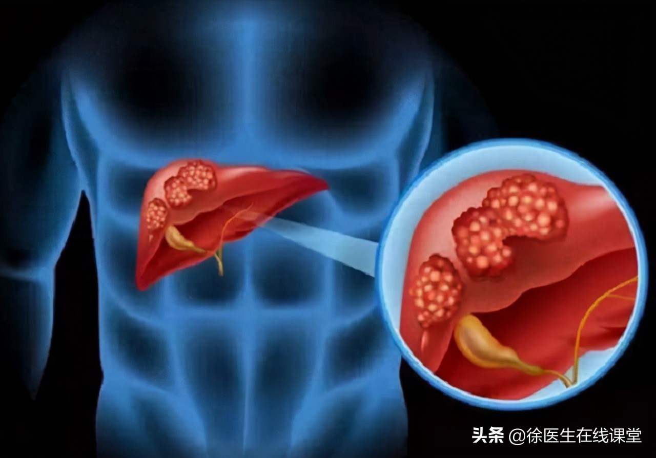 乙肝严不严重，不是看表面抗原和病毒DNA，这些检查你得了解