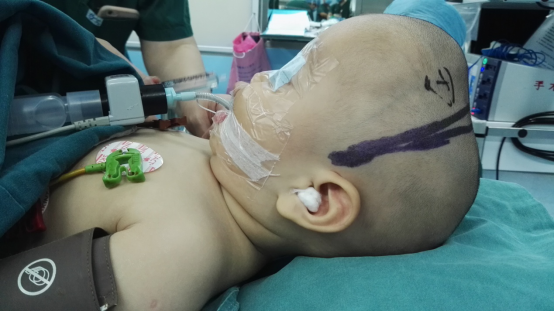 孩子的头大、头小、偏头，方颅，是什么原因？一次性弄清楚