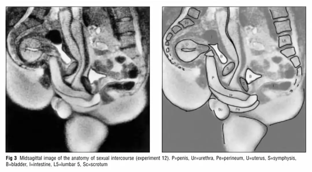 性行为时生殖器会变成什么样子？20年前就有科学家研究了
