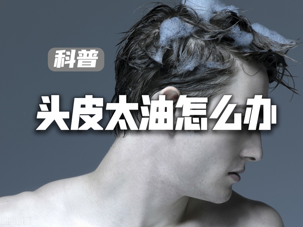 头皮油腻怎么办？了解头皮出油机制，方能找到控油技巧