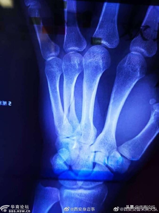 每日最陕西｜捂死8月孕妻伪造交通事故 陕西清涧变心男子被执行死刑