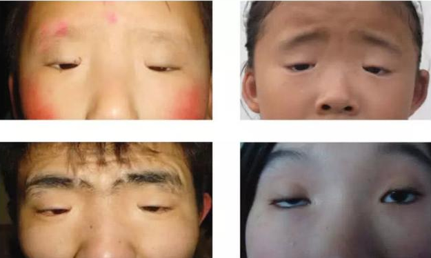 三个月宝宝眼睛过小,宝妈分不清眼睛是否睁开,医生的话太搞笑