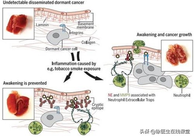 血型真的决定寿命？A型、B型、AB型、O型，哪种血型更长寿？