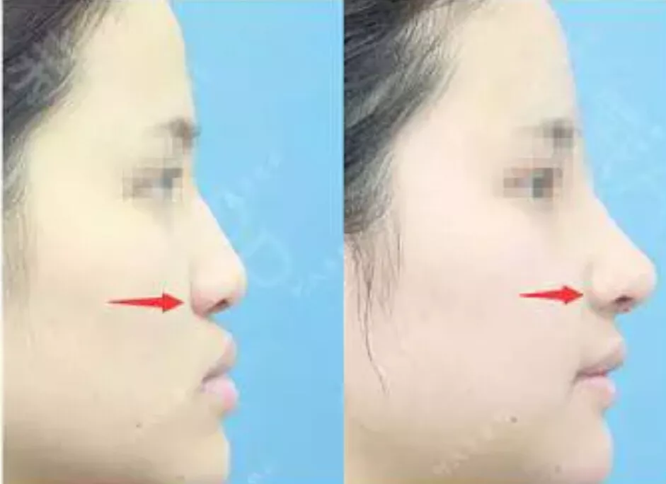 惊!竟然有人喷古天乐五官?他的骨相简直是完美的,好吗?