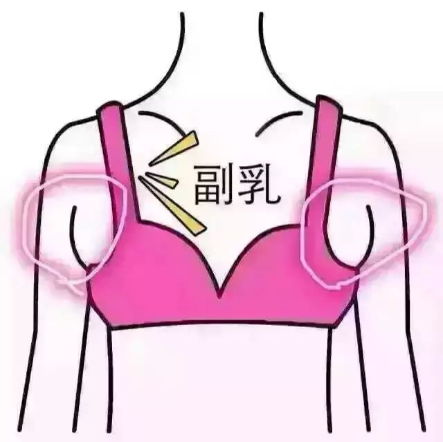 你有副乳嗎?知道它的危害有多強大嗎?