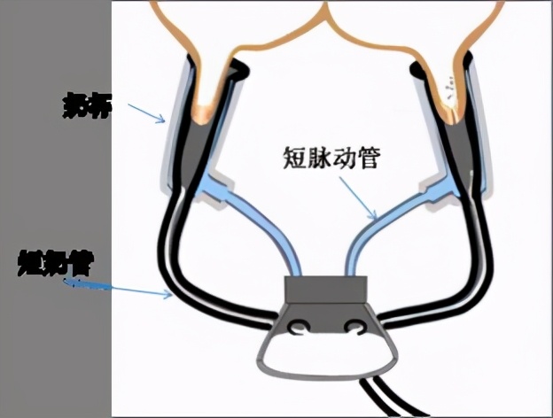 奶牛擠奶奶襯選擇？