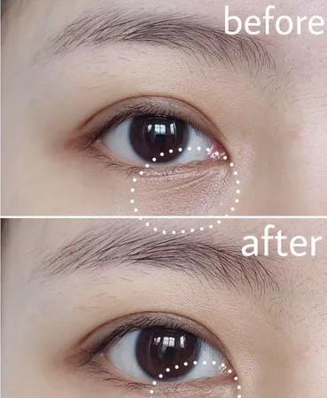 这款“抗衰老”眼霜，淡化细纹和黑眼圈，爱美的你一定要知道