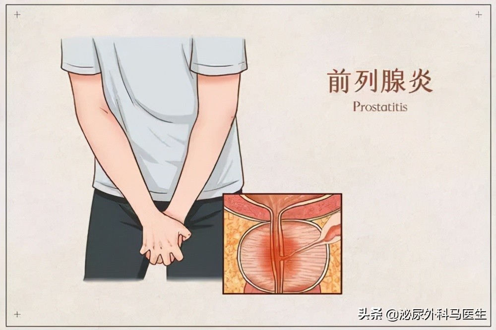 男性尿道口总有分泌物是怎么回事？正常吗？