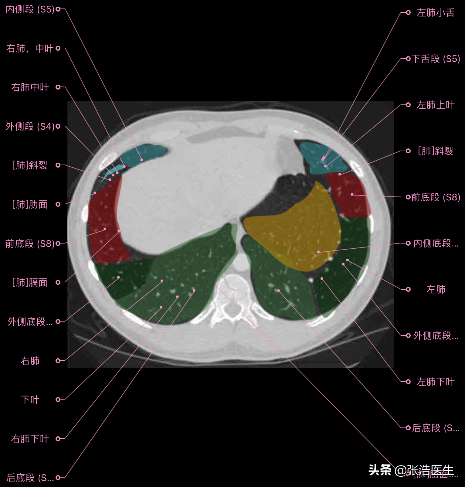 肺的分叶分段的ct图图片
