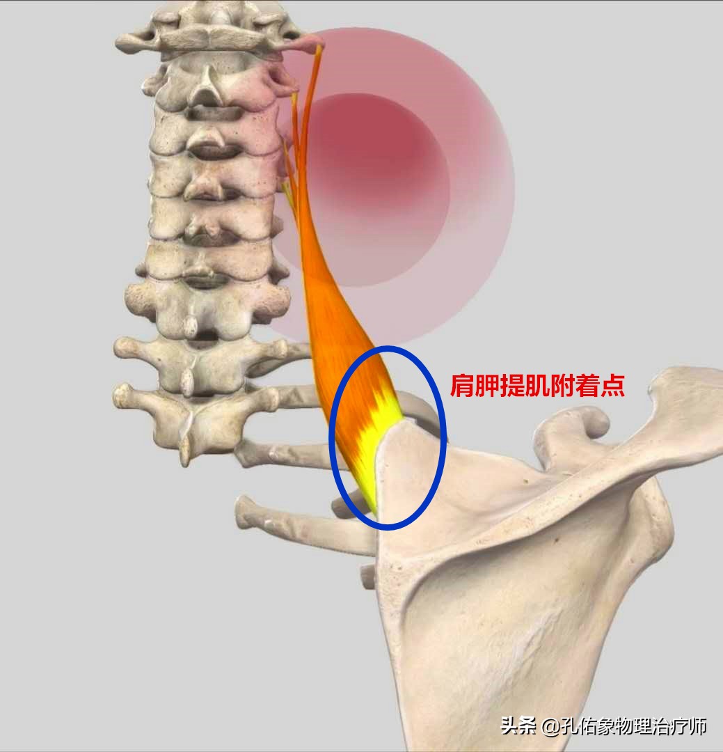 后背,肩胛骨区域疼痛是怎么回事?如何应对?告诉您