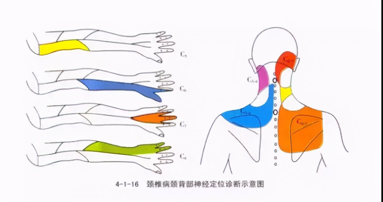经常手麻绝不是忍一忍就过去了，背后可能有大问题