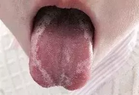 学会简单舌诊，教你轻松带娃