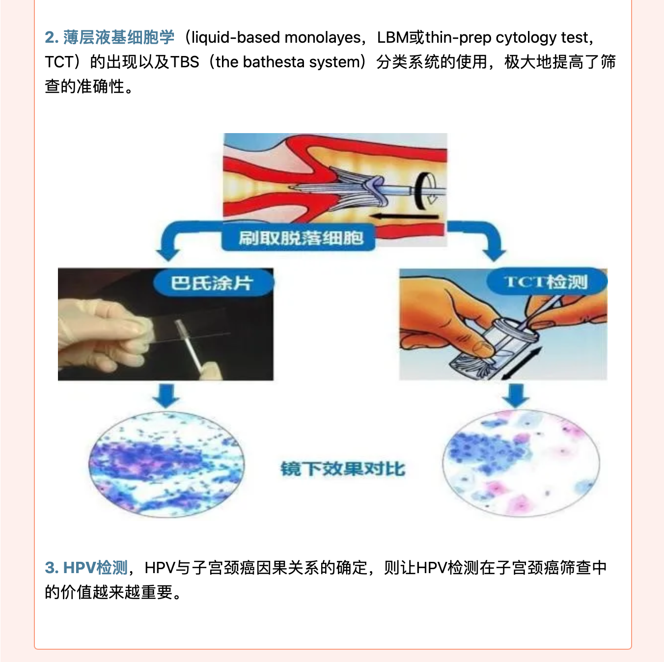 规范化筛查，远离宫颈肿瘤