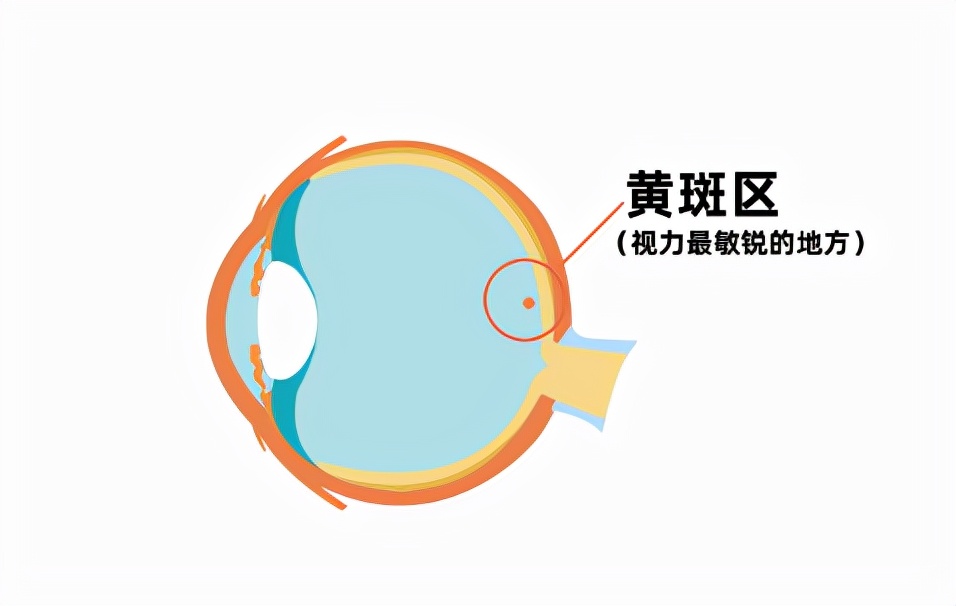 多次验配眼镜却看不清楚，竟是眼内多长了一层膜，50岁以上高发