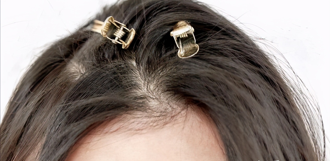 容易贴头皮睡觉时把头发捋到头顶② 吹风机吹发技巧用吹风机对着发根