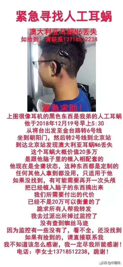 “天价”人工耳蜗丢失引全城寻找……是炒作?